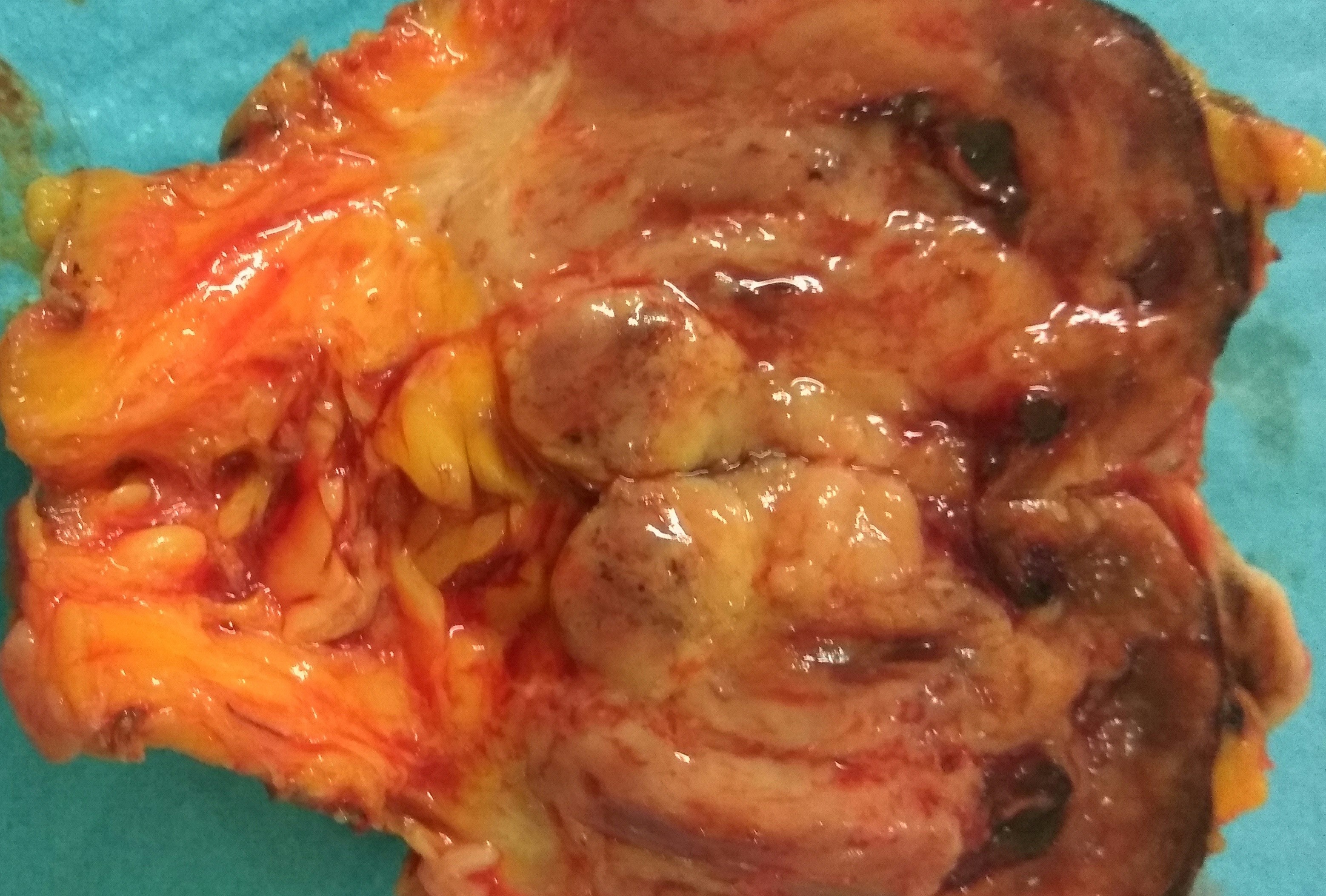 Επιφάνεια τομής παρασκευάσματος