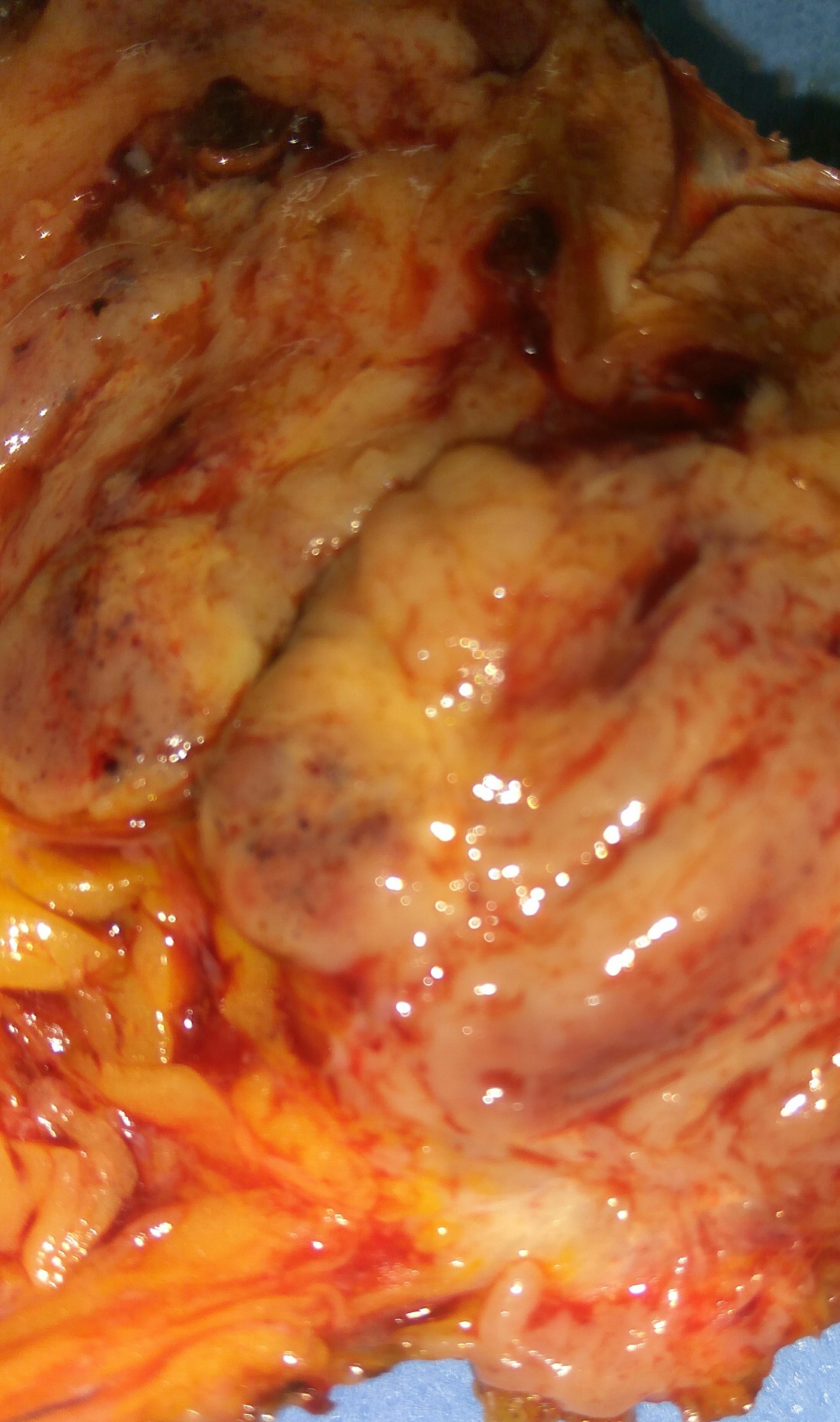 Επιφάνεια τομής παρασκευάσματος