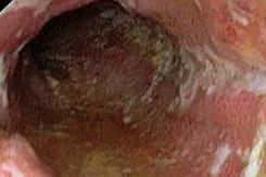 Ορθοσκόπηση