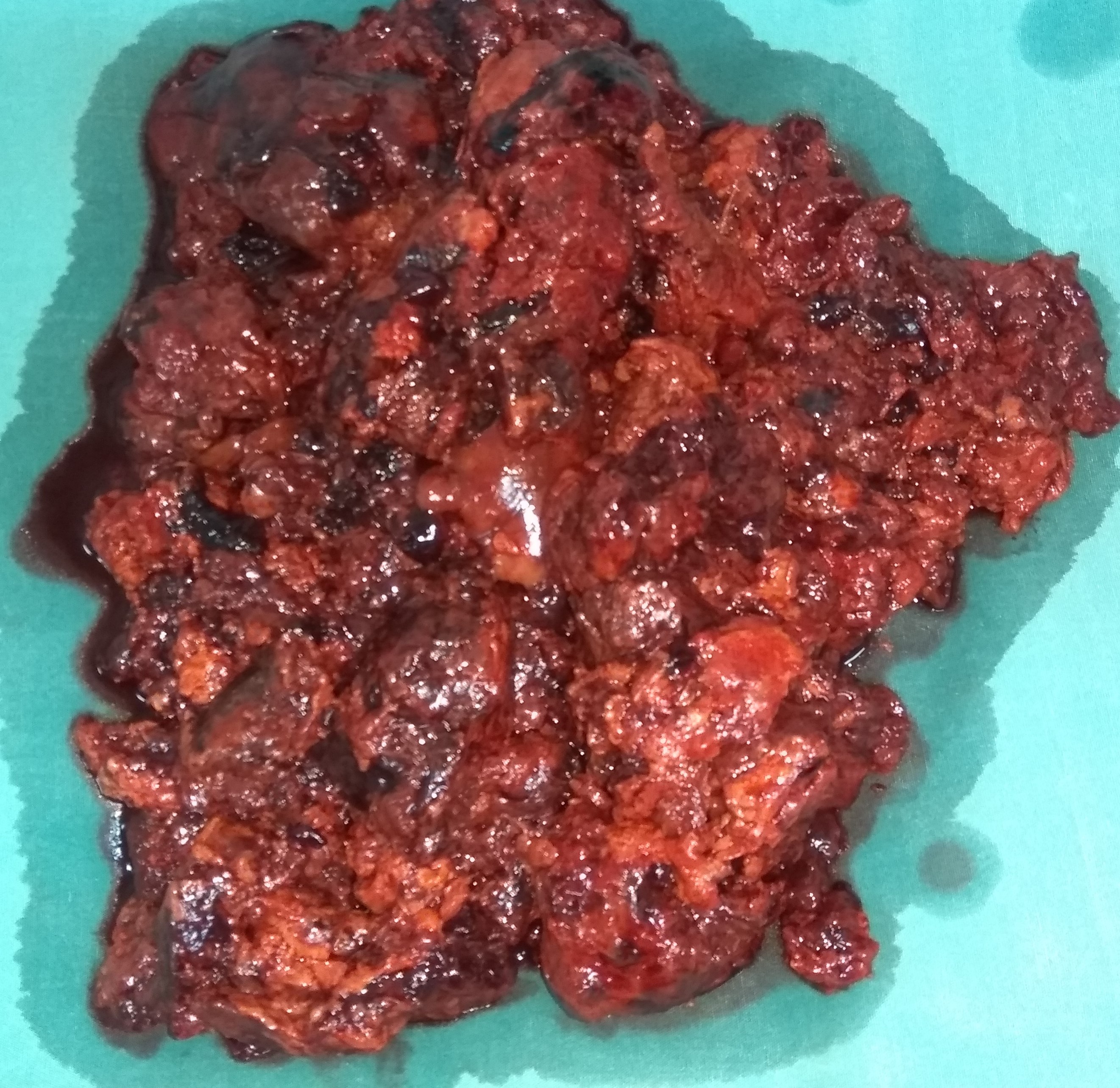 Εκταμέν υποτροπιάζον οπισθοπεριτοναϊκό επιθηλιοειδές αγγειοσάρκωμα