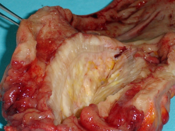 Σχήμα 4 . Κομμένη επιφάνεια του δοκιμίου (ευγενική παραχώρηση Δρ. Β. Πενόπουλος) .