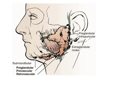 Excised Hodgkin s Parotid Lymphoma (Courtesy Dr. V. Penopoulos)