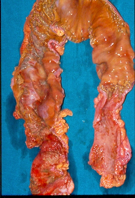 Κλινική απεικόνιση (Ευγενική παραχώρηση Dr. V. Penopoulos)