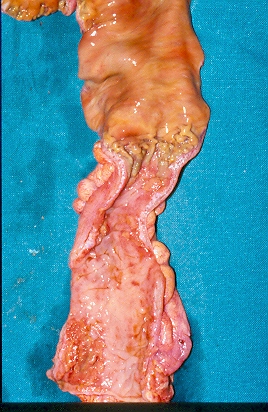 Κλινική απεικόνιση (Ευγενική παραχώρηση Dr. V. Penopoulos)