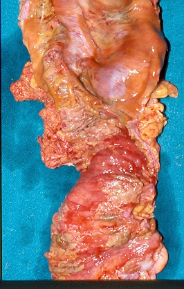Κλινική απεικόνιση (Ευγενική παραχώρηση Dr. V. Penopoulos)