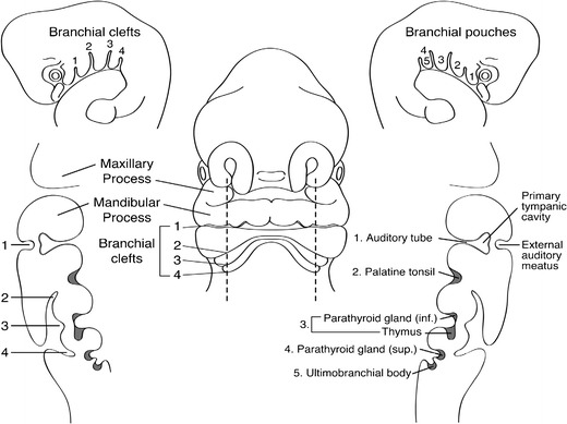 2nd branchial cleft cyst (Courtesy Dr. V. Penopoulos)
