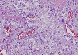Figure 4.Histopathological examination.See report below.