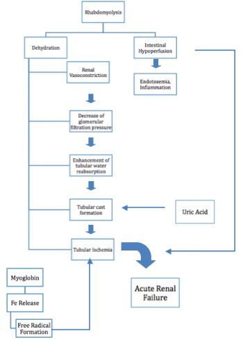 Ούρα ασθενούς με ραβδομυόλυση (Ευγενική παραχώρηση Dr. V. Penopoulos)