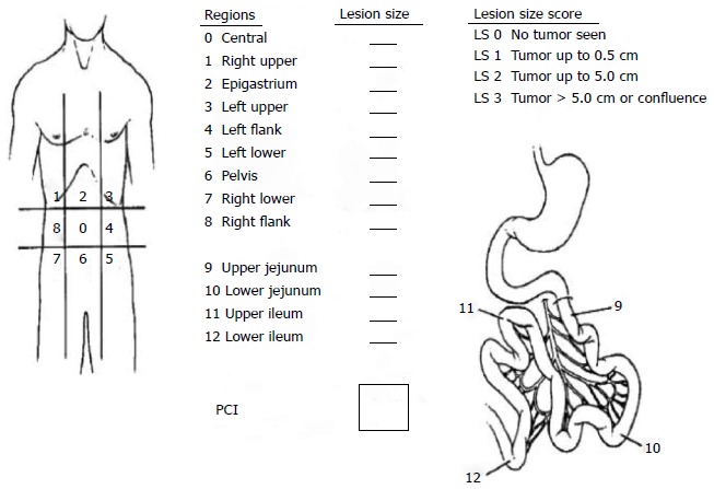 Multiple hepatic metastases — Absolute contraindication for cytoreductive surgery (Courtesy Dr. V. Penopoulos)