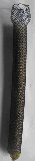 Stent Niti-S (Ευγενική παραχώρηση Dr. V. Penopoulos)