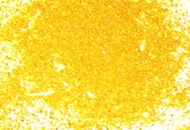 CD79a positivity (Courtesy Dr. V. Penopoulos)