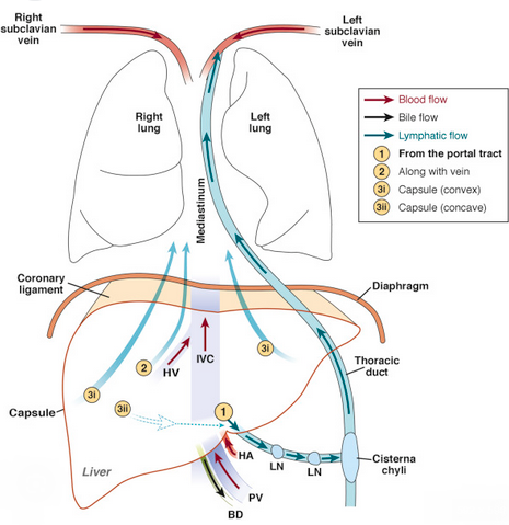 Peritoneovenous shunt in another patient with decompensated hepatic cirrhosis (Courtesy Dr. V. Penopoulos)