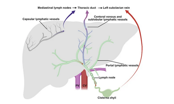 Peritoneovenous shunt in another patient with decompensated hepatic cirrhosis (Courtesy Dr. V. Penopoulos)