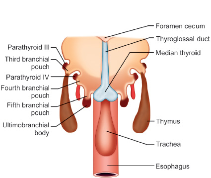 Cut specimen of excised parathyroid adenoma (Courtesy Dr. V. Penopoulos)