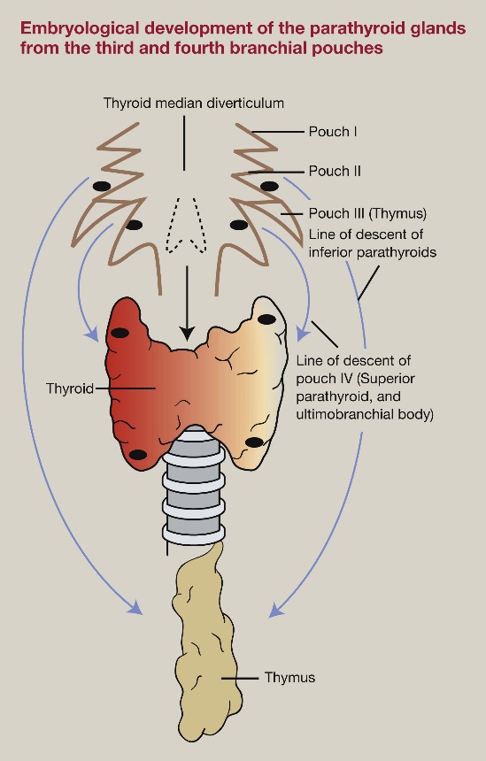 Cut specimen of excised parathyroid adenoma (Courtesy Dr. V. Penopoulos)