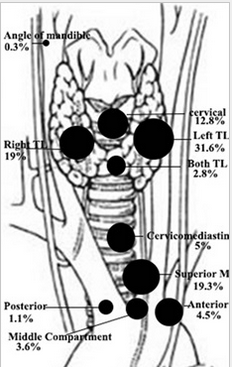 Parathyroid cells — Clear cells (Courtesy Dr. V. Penopoulos)