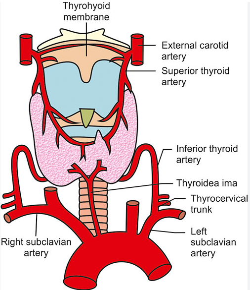 Χειρουργικό παρασκεύασμα οπισθοστερνικής βρογχοκήλης (Ευγενική παραχώρηση Dr. V. Penopoulos)