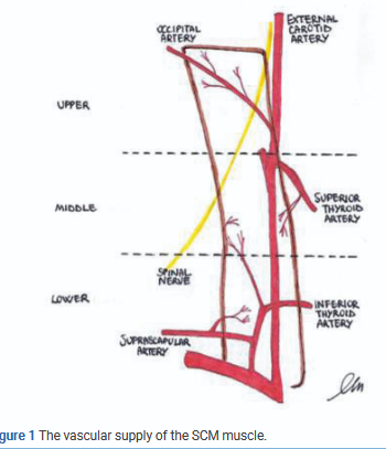 Blood supply of the sternocleidomastoid muscle (Courtesy Dr. V. Penopoulos)