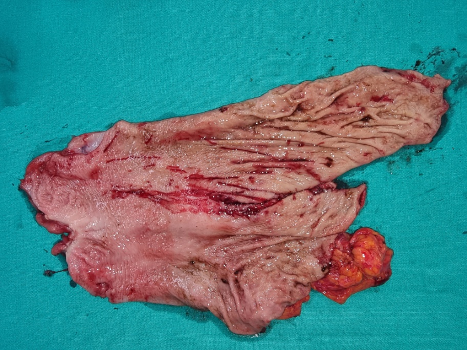 Electron micrograph demonstrating the SIP syncytium in the guinea pig stomach. Panel A, Mitsui & Komuro. Cell Tissue Res 2002;309:219-227; Panel B-D, Sung TS, et al. J Physiol 2018;596:1549-1574; Panel E, Sanders KM et al. J Physiol 2010;588:4621-4639 (Courtesy Dr. V. Penopoulos)