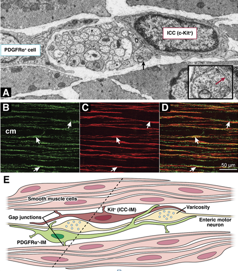 Electron micrograph demonstrating the SIP syncytium in the guinea pig stomach. Panel A, Mitsui & Komuro. Cell Tissue Res 2002;309:219-227; Panel B-D, Sung TS, et al. J Physiol 2018;596:1549-1574; Panel E, Sanders KM et al. J Physiol 2010;588:4621-4639 (Courtesy Dr. V. Penopoulos)