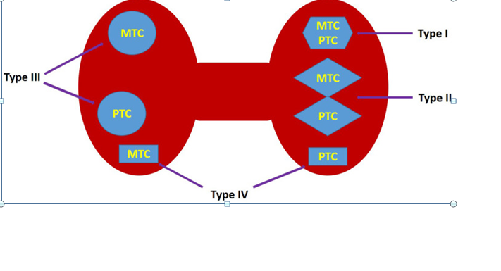 Cervical ultrasound. Green arrow: Papillary carcinoma. Red arrow: Medullary carcinoma (Courtesy Dr. V. Penopoulos)