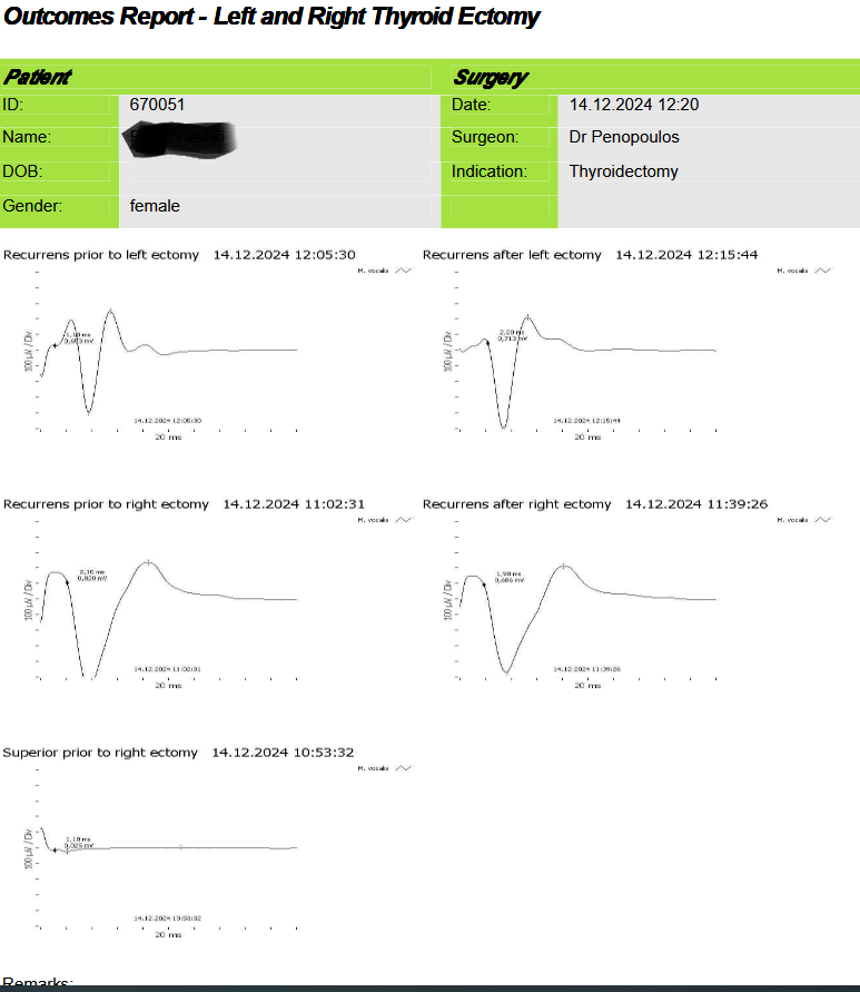 Inferior laryngeal nerve monitoring before and after total thyroidectomy (Courtesy Dr. V. Penopoulos)
