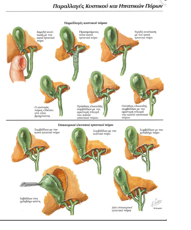 Green arrow: gallstones. Blue arrow: blind orifice of the cystic duct (Courtesy Dr. V. Penopoulos)