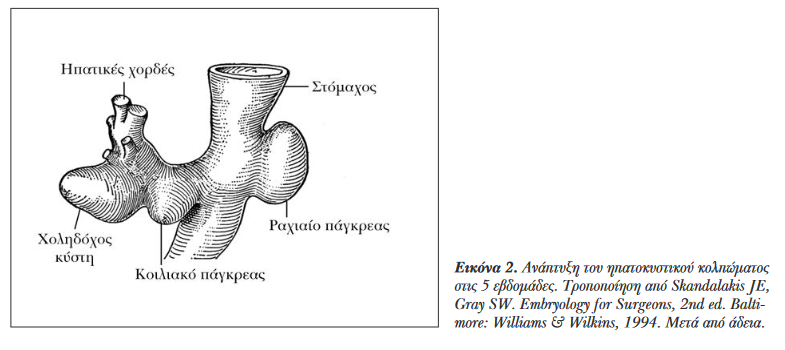 Green arrow: gallstones. Blue arrow: blind orifice of the cystic duct (Courtesy Dr. V. Penopoulos)