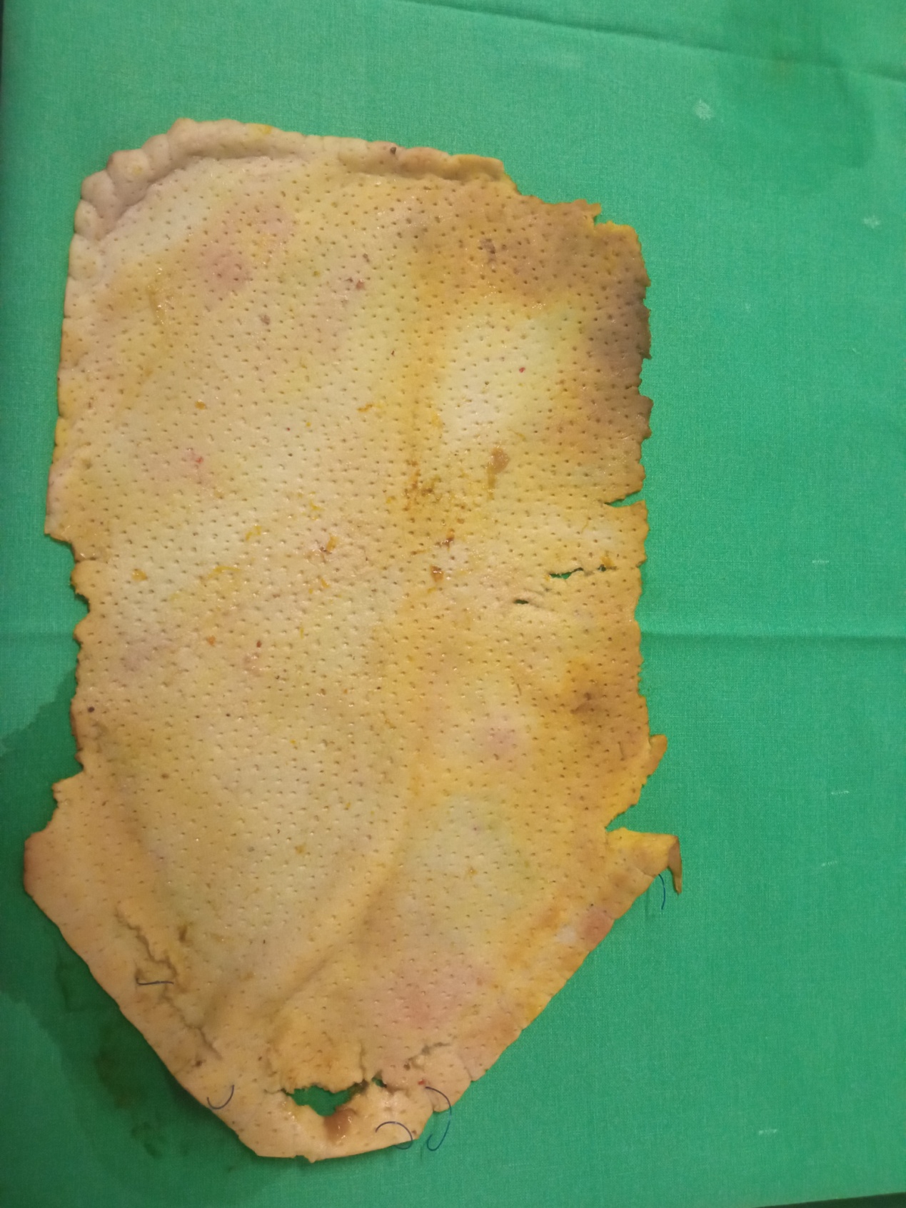 Removed Permacol mesh (Courtesy Dr. V. Penopoulos)