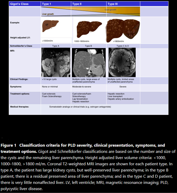 Polycystic liver disease (Courtesy Dr. V. Penopoulos)