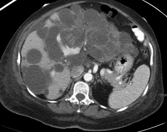 The patient on the operating table (Courtesy Dr. V. Penopoulos)