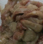 Contents of the cyst. Sticky, yellow-green in color (Courtesy Dr. V. Penopoulos)