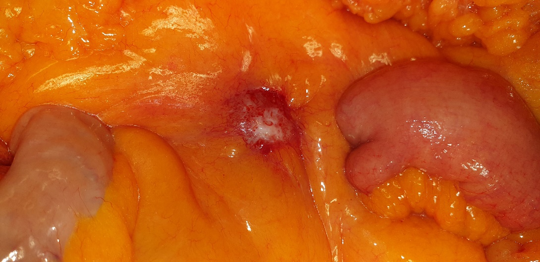 Cross-section of the specimen (Courtesy Dr. V. Penopoulos)