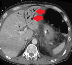 Μακροσκοπική άποψη τμήματος παρασκευάσματος (Ευγενική παραχώρηση Dr. V. Penopoulos)