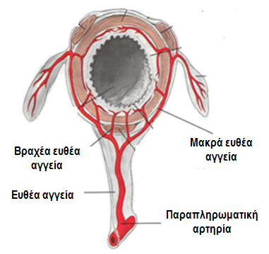 Κολονοσκόπηση. Ευδιάκριτα ευρήματα ισχαιμικής κολίτιδας (Ευγενική παραχώρηση Dr. V. Penopoulos)