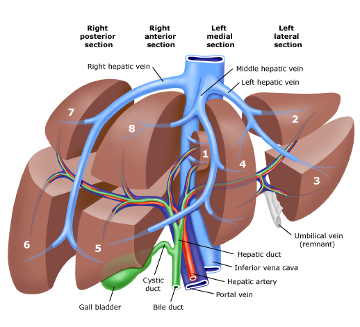 Large metastatic hepatic lesion, involving segments V, VI, VII, and part of VIII, 4.5 years after abdominoperineal resection of the rectum for poorly differentiated adenocarcinoma (Courtesy Dr. V. Penopoulos)