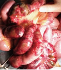 NON OCCLUSIVE ISCHAEMIC DISEASE