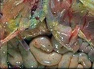 PERITONITIS