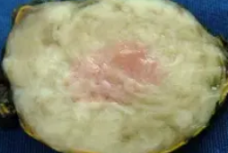 ADRENAL LEIOMYOMA