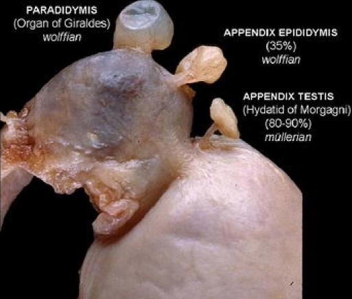 TESTICULAR APPENDAGES