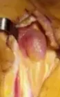 GANGLION