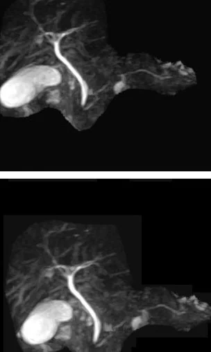 PANCREATIC TRAUMA