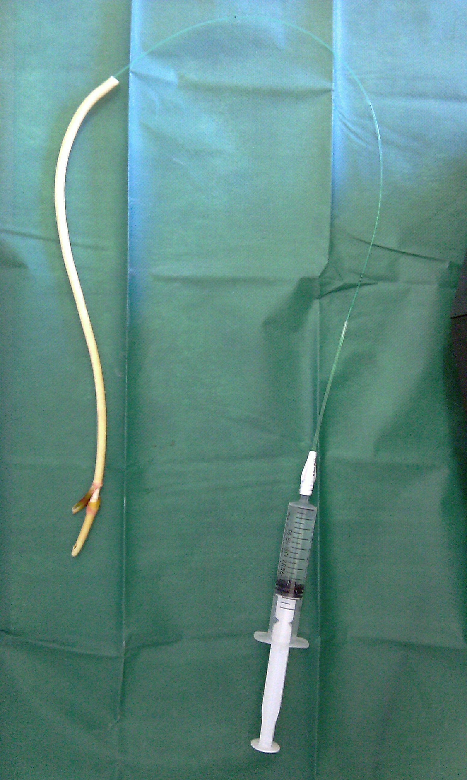 MALFUNCTIONING FOLEY CATHETER - BALLOON RUPTURE
