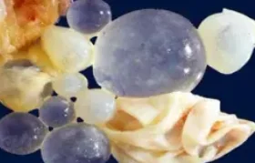 HYDATID CYSTS